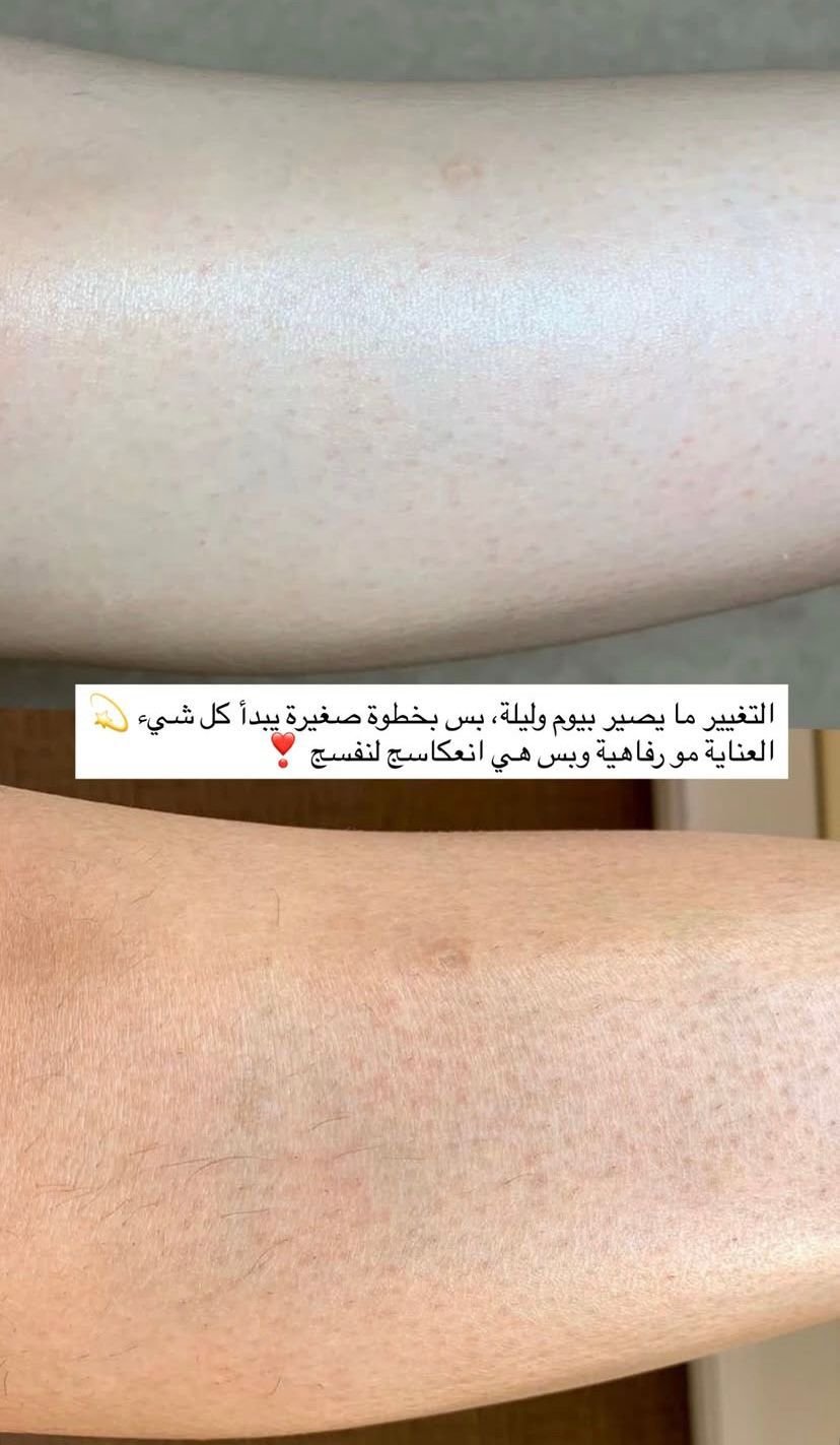 WhatsApp Image 2026-03-05 at 9.14.57 AM