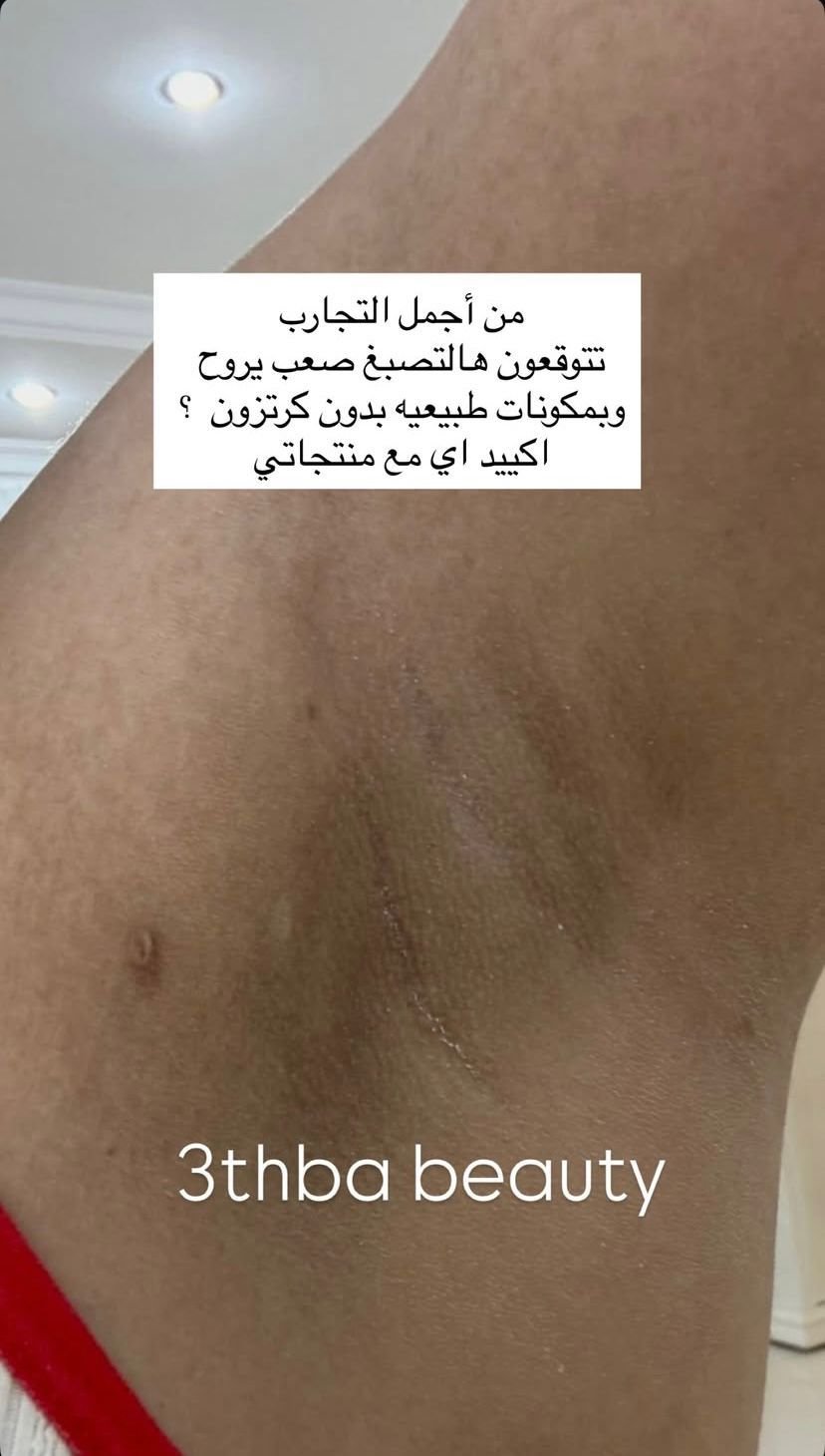 WhatsApp Image 2026-03-05 at 9.14.59 AM