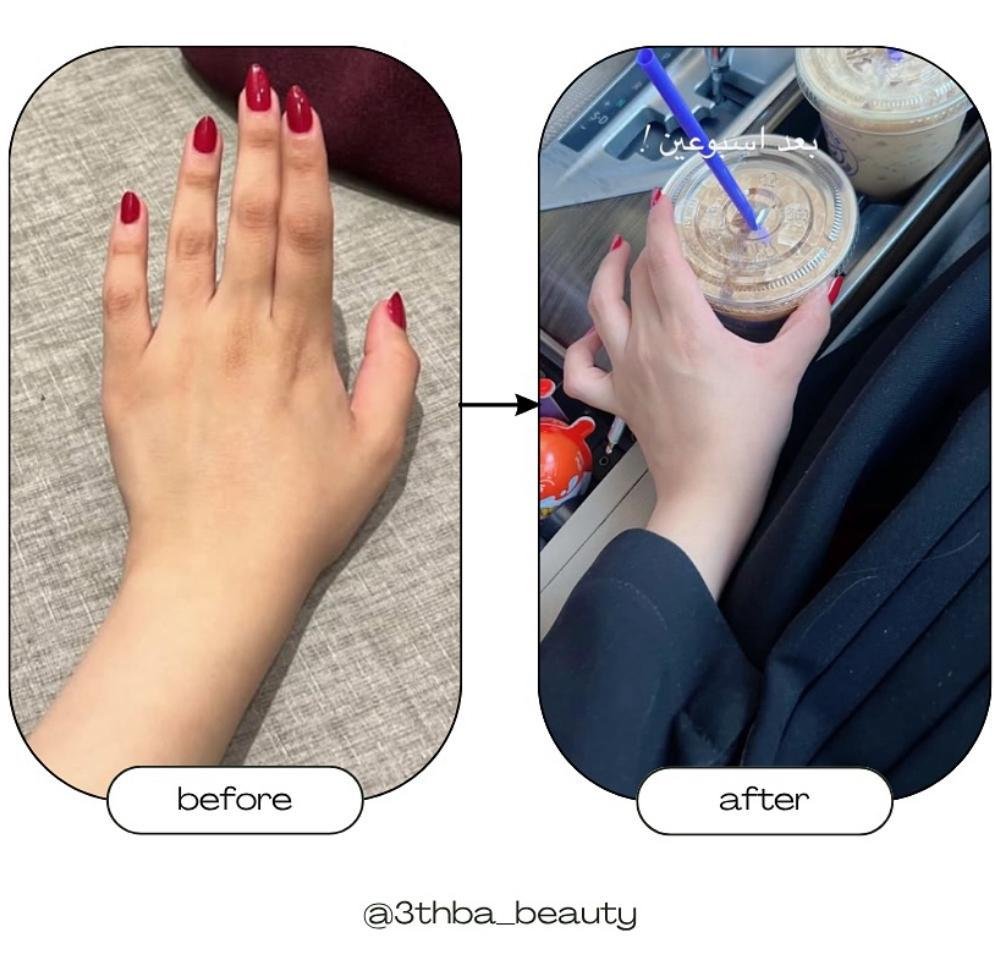 WhatsApp Image 2026-03-05 at 9.15.10 AM